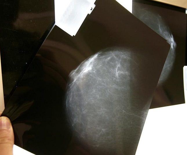 desigualdades mujeres cáncer