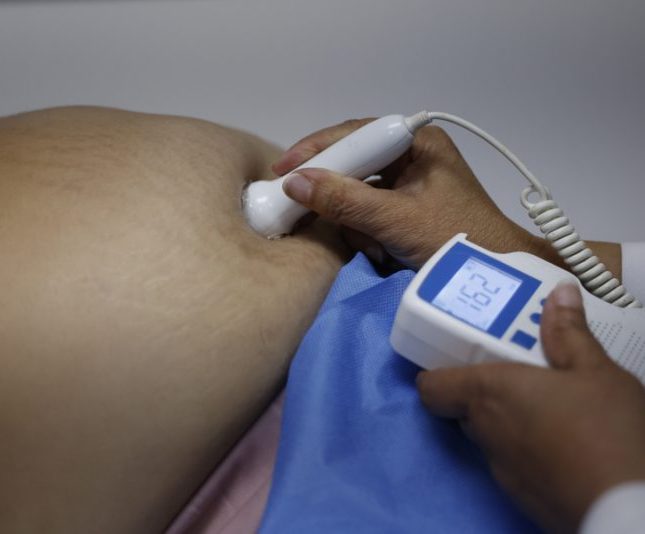 violencia obstétrica Ecuador
