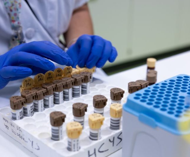 Investigadoras cáncer páncreas