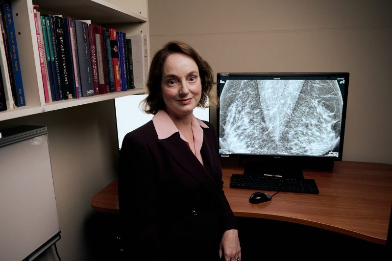 Inteligencia artificial cáncer de mama