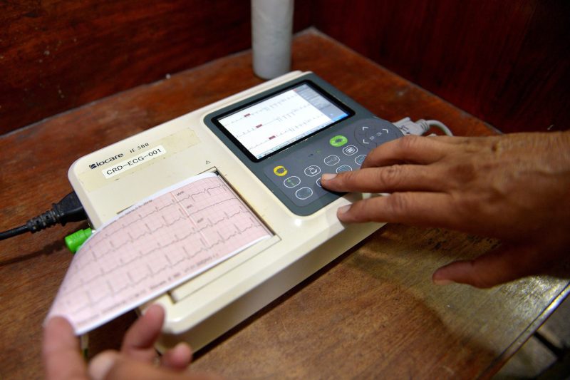 riesgo cardiovascular en la menopausia
